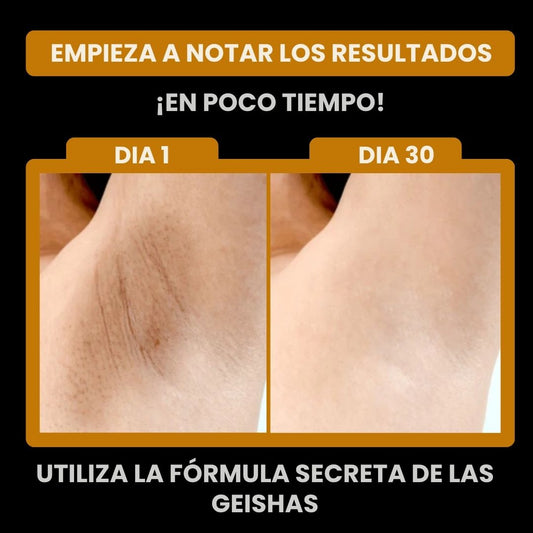 KojicSoap™ | Jabón ácido Kojico y curcuma — Despígmenta y Aclara tu Piel